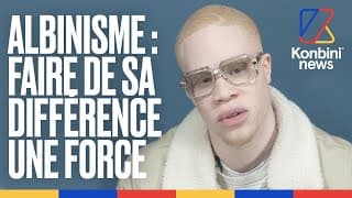 Le youtuber KENTRA c'est un AFRICAIN ALBINOS ou un BLANC ?