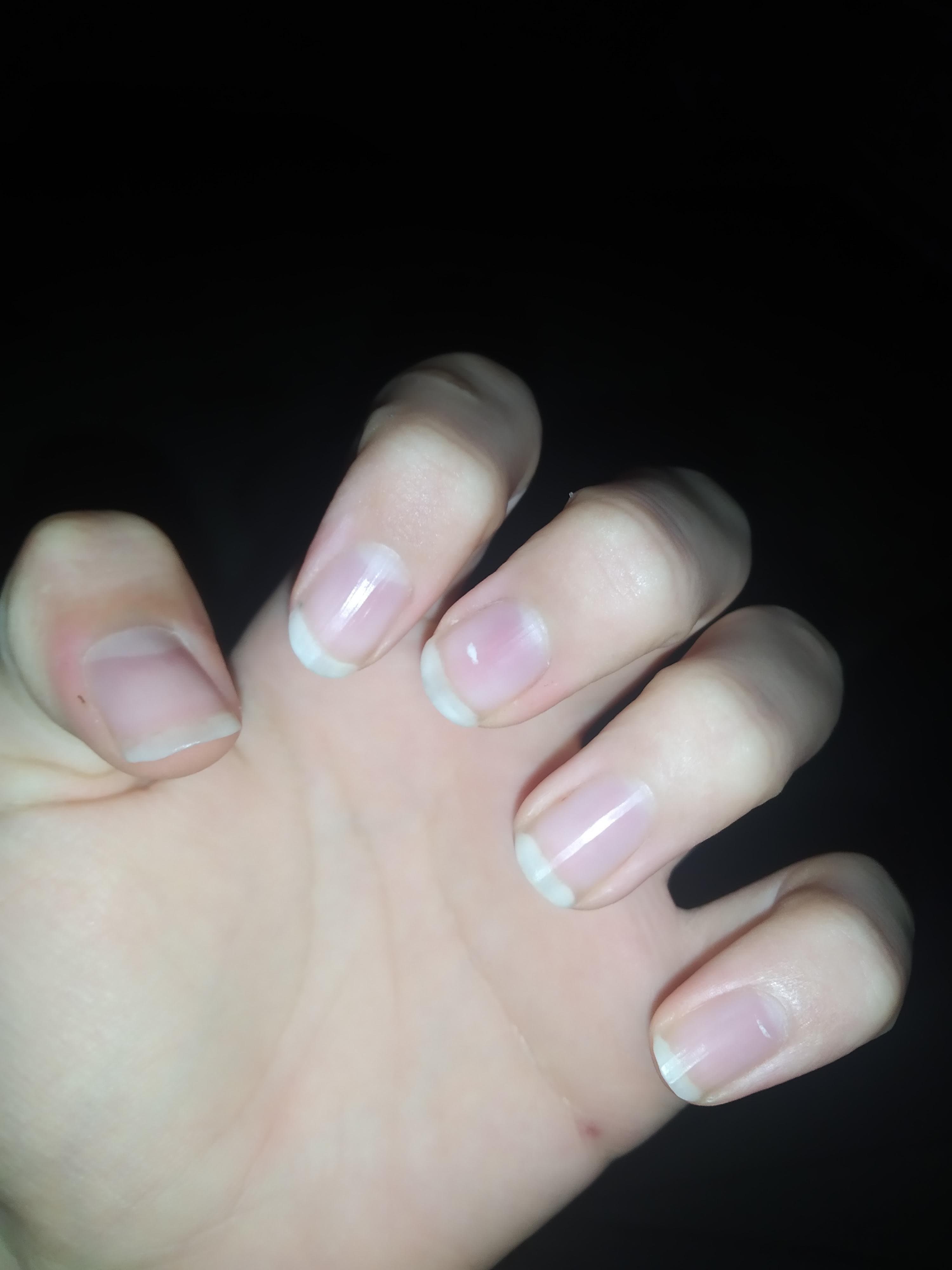 [PHOTO] j'ai fait mes ongles