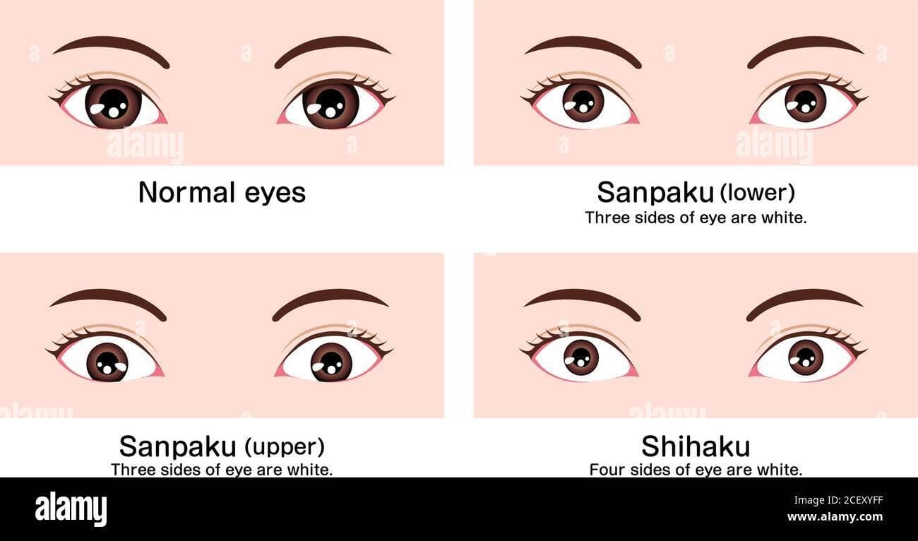 Avez vous les sanpaku eyes ?