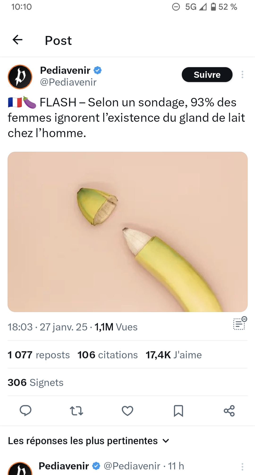 [PHOTO] AYAA le délire gland de lait qui devient international