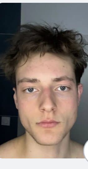 Améliorer le visage 🧬💥