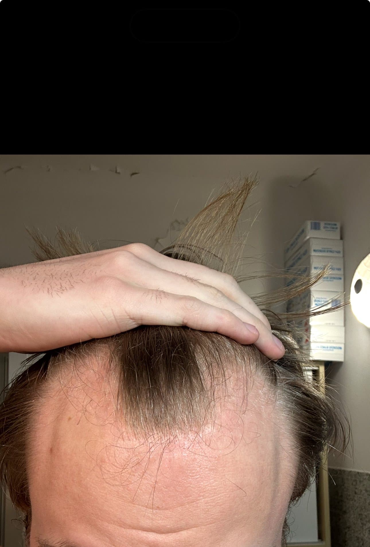 Minoxidil ou finasteride selon vous ?