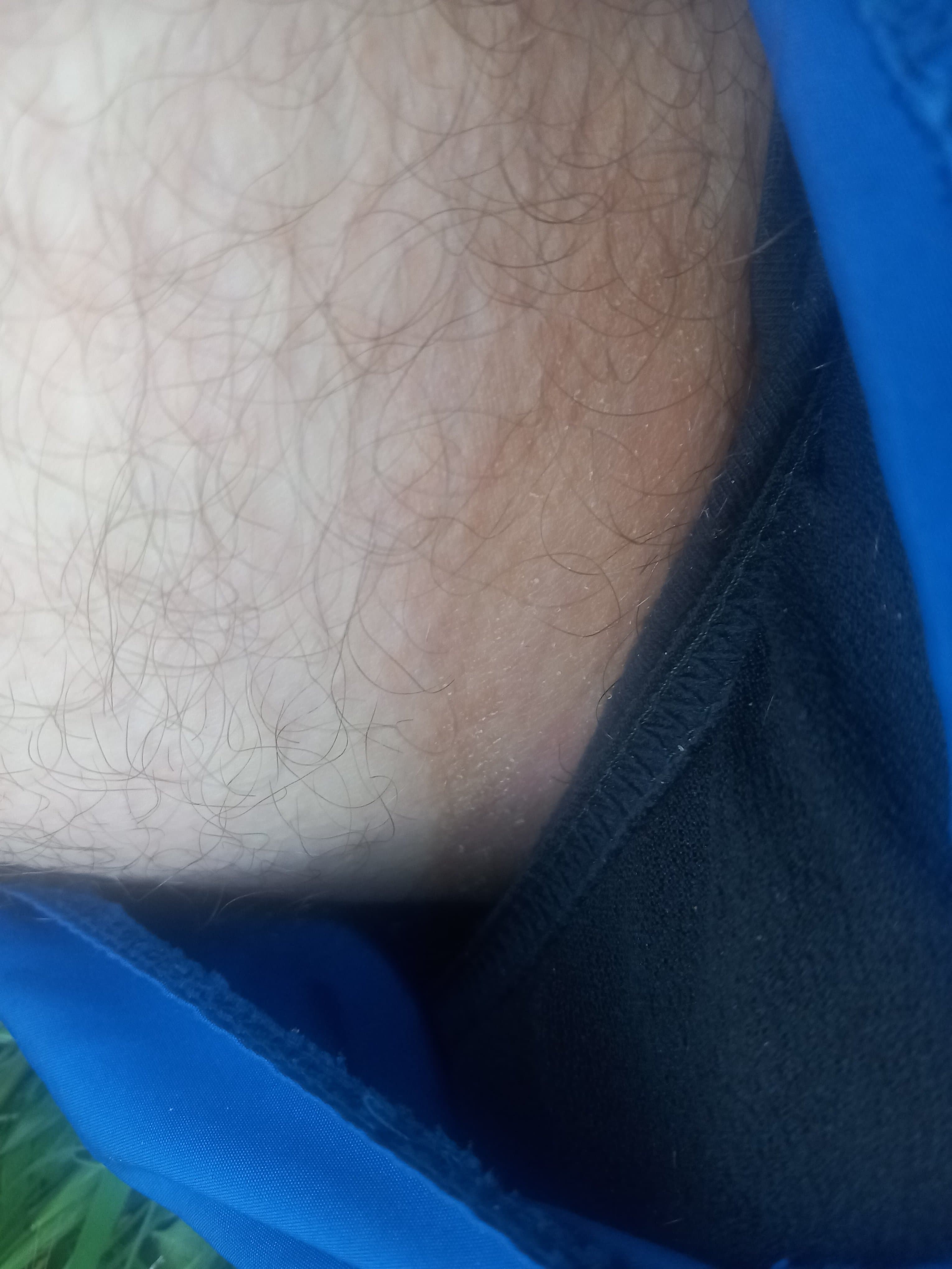 [PHOTO] vous avez la marque des couilles sur vos cuisses ?