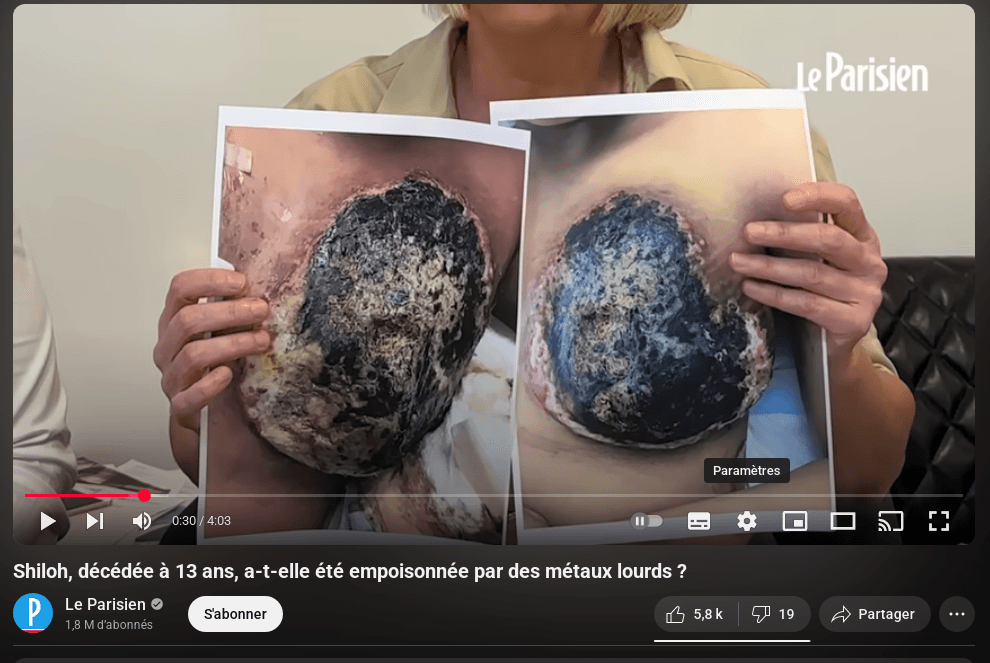 Cette vidéo va vous horrifier, elle meurt à 13 ans