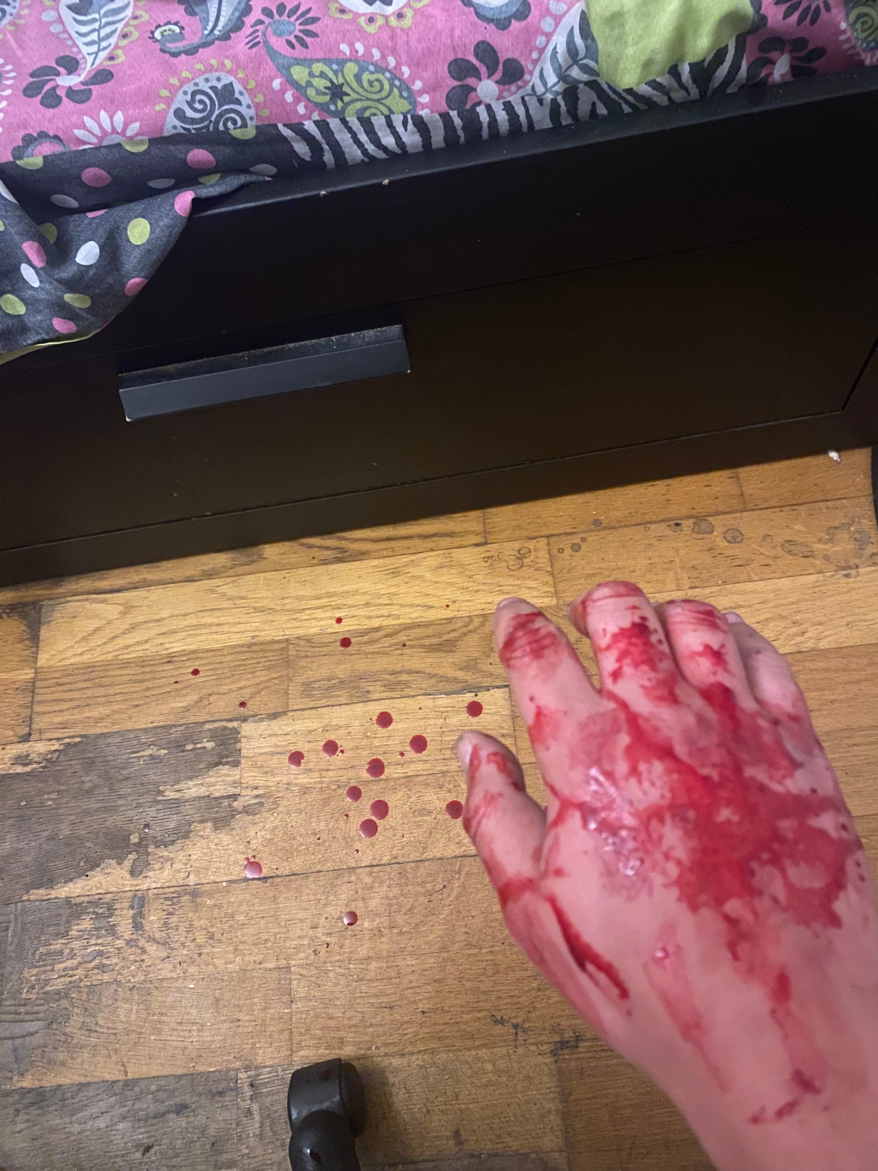 Bon j'suis pas médecin mais on est d'accord, c'est pas bon ça ?