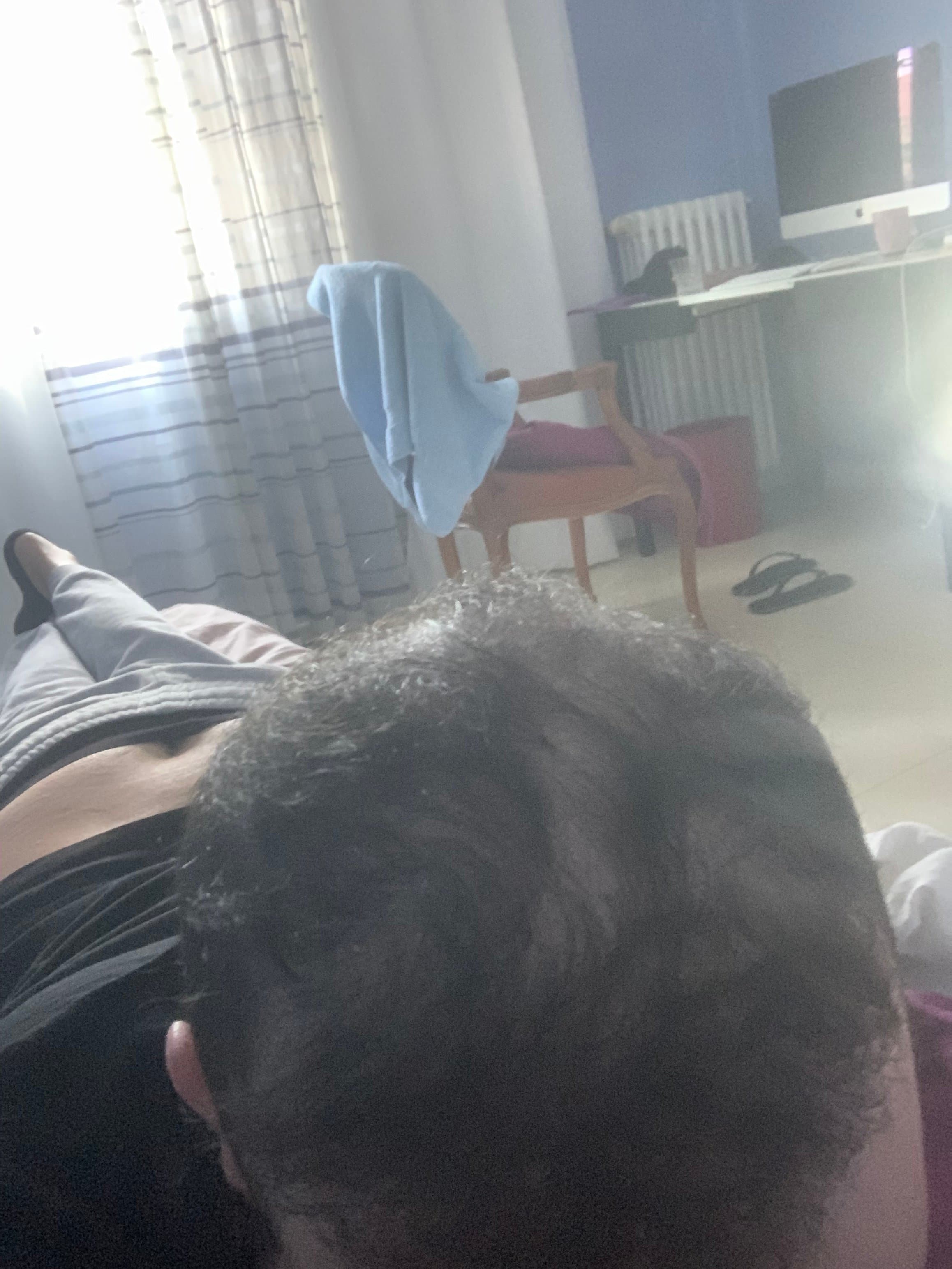 Je peux draguer avec cette calvitie ?