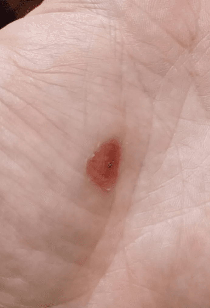 une ampoule a la main