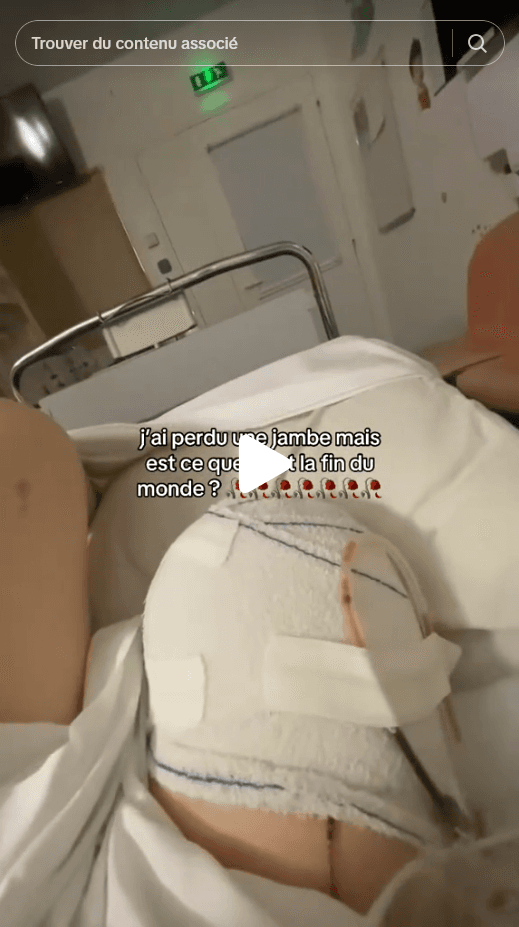 [AMPUTATION] Une TEEN 8/10 perd une JAMBE et ouvre un TIKTOK