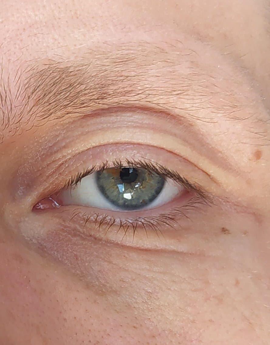 Concrètement c'est quoi le problème à cet oeil là ?