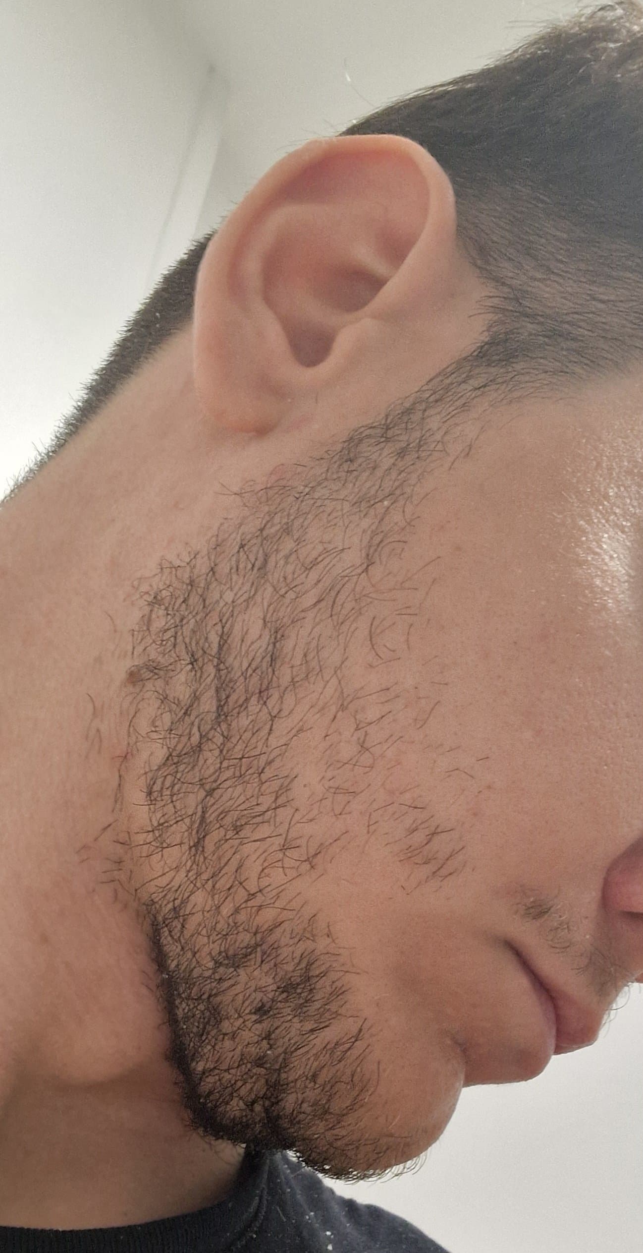 [Barbe] Avant ou après ?