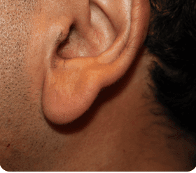 Ce genre de lobe d'oreille ça peut attirer les femmes ?
